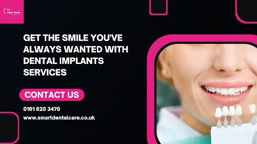 Get the Smile You’ve Always Wanted with Dental Implants Services
