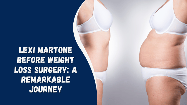 Lexi Martone Before Weight Loss Surgery A Remarkable Journey