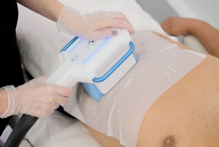 Cryolipolysis Explained: How Fat Freezing Works to Sculpt Your Body