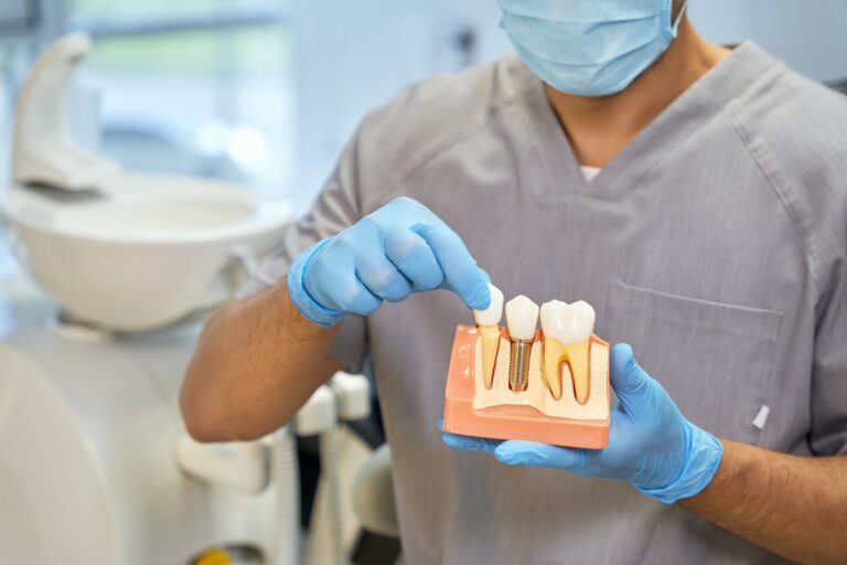 Navigating Insurance: How to Get Dental Implants Covered by Medical Insurance