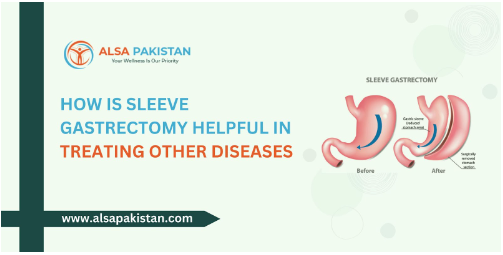 How is sleeve gastrectomy helpful in treating other diseases?
